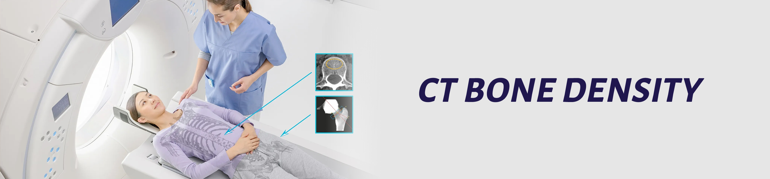 CT Bone Density Banner